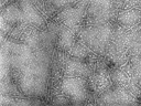 Potato virus X (genus Potexviruses; family Alphaflexiviridae)