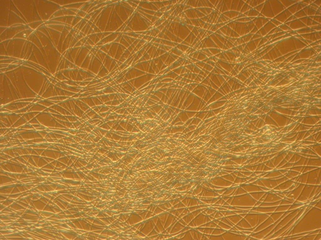 Microrganismo filamentoso Microtrix parvicella 